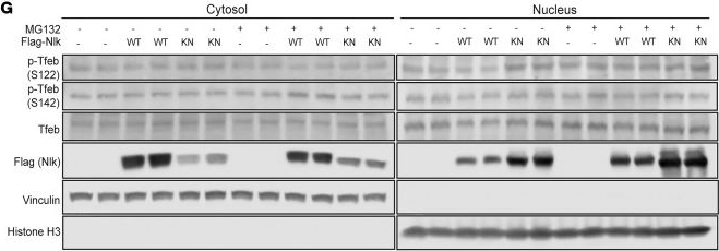 Fig.2.G showing Western Blotting from the publication: Reduction of nemo-like kinase increases lysosome biogenesis and ameliorates TDP-43-related neurodegeneration.