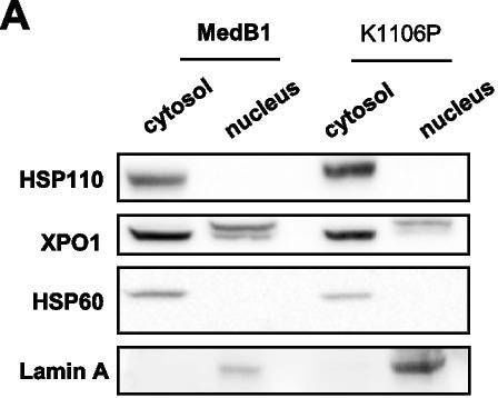 Fig.2.A showing Western Blotting in a Homo sapiens (Human) sample from the publication: A first-in-class inhibitor of HSP110 to potentiate XPO1-targeted therapy in primary mediastinal B-cell lymphoma and classical Hodgkin lymphoma.