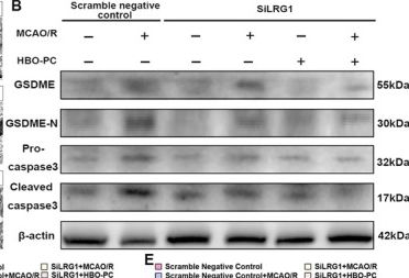 Fig.5.B showing Western Blotting in a Rattus norvegicus (Rat) sample from the publication: HBO-PC Reprograms Neuroimmune Metabolism Through Disruption of the LRG1-HIF-1α-IL-6-STAT3 Amplification Loop Attenuates Pyroptosis and Ischemia-Reperfusion Injury.