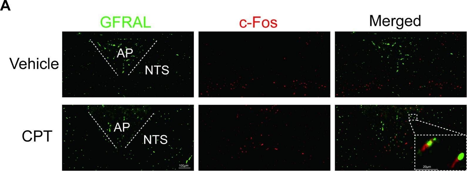 Fig.6.A showing Immunocytochemistry-immunofluorescence from the publication: Camptothecin effectively treats obesity in mice through GDF15 induction.