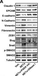 Fig.4.A showing Western Blotting from the publication: Mechanistic and functional characterization of NETs/IL-17 as a therapeutic target in EMT and brain metastasis of lung adenocarcinoma.