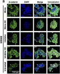 Fig.3.B showing Immunocytochemistry-immunofluorescence in a Homo sapiens (Human) sample from the publication: Exploring the impact of MiR-92a-3p on FOLFOX chemoresistance biomarker genes in colon cancer cell lines.