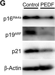 Fig.2.G showing Western Blotting in a Mus musculus (House mouse) sample from the publication: Roles of pigment epithelium-derived factor in exercise-induced suppression of senescence and its impact on lung pathology in mice.