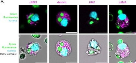 Fig.5.A showing Immunocytochemistry-immunofluorescence from the publication: Purification and Transcriptomic Characterization of Hypertrophied Hepatic Stellate Cells From CDAHFD Mouse Liver.