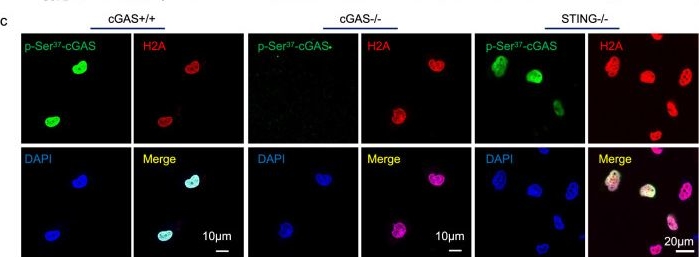Fig.4.C showing Immunocytochemistry-immunofluorescence in a Homo sapiens (Human) sample from the publication: mTORC2-driven chromatin cGAS mediates chemoresistance through epigenetic reprogramming in colorectal cancer.