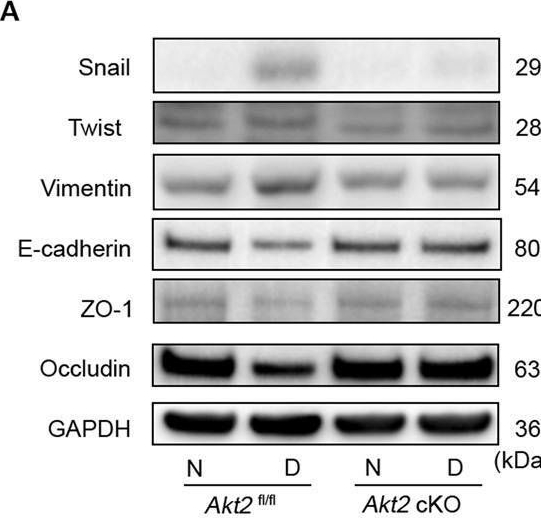 Fig.4.A showing Western Blotting in a Mus musculus (House mouse) sample from the publication: Aberrant Akt2 signaling in the RPE may contribute to retinal fibrosis process in diabetic retinopathy.
