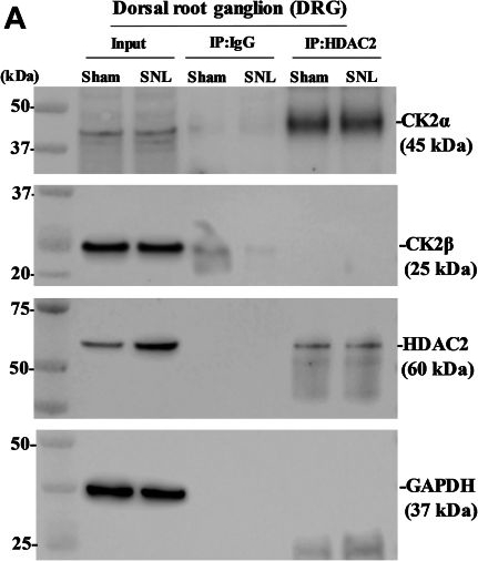 Fig.2.A showing Western Blotting in a Rattus norvegicus (Rat) sample from the publication: Nerve injury augments Cacna2d1 transcription via CK2-mediated phosphorylation of the histone deacetylase HDAC2 in dorsal root ganglia.