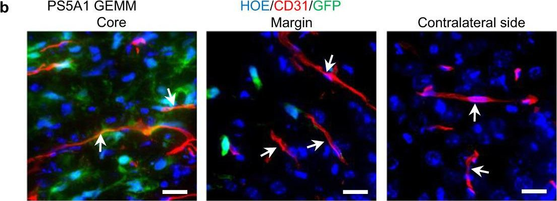 Fig.2.B showing Immunohistochemistry in a Mus musculus (House mouse) sample from the publication: Optical blood-brain-tumor barrier modulation expands therapeutic options for glioblastoma treatment.
