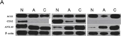 Fig.6.A showing Western Blotting in a Homo sapiens (Human) sample from the publication: High-throughput proteomics integrated with gene microarray for discovery of colorectal cancer potential biomarkers.