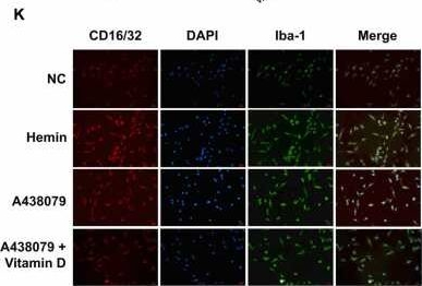 Fig.5.K showing Immunocytochemistry-immunofluorescence from the publication: Vitamin D alleviates intracerebral hemorrhage symptoms by modulating pro-inflammatory/anti-inflammatory phenotypic transformation of microglia through P2X7R activation of NLRP3.