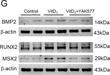 Fig.7.G showing Western Blotting in a Mus musculus (House mouse) sample from the publication: YAK577 Attenuates Vascular Calcification by Targeting an MMP14-NOX2/ROS Axis in VSMCs and a Vitamin D3-Induced Mouse Model.