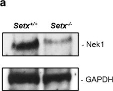 Fig.4.A showing Western Blotting from the publication: Senataxin controls meiotic silencing through ATR activation and chromatin remodeling.