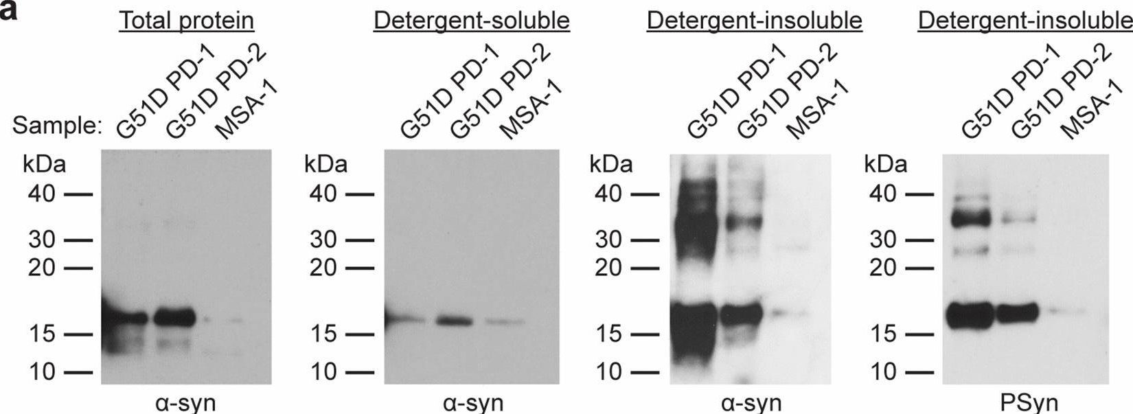 Fig.1.A showing Western Blotting from the publication: The G51D SNCA mutation generates a slowly progressive α-synuclein strain in early-onset Parkinson's disease.