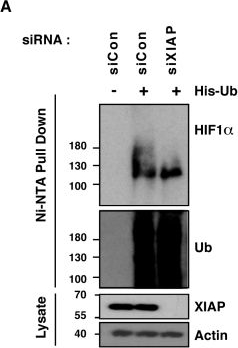 Fig.1.A showing Western Blotting in a Homo sapiens (Human) sample from the publication: XIAP upregulates expression of HIF target genes by targeting HIF1α for Lys63-linked polyubiquitination.
