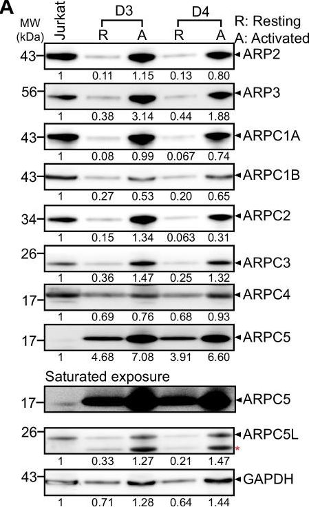 Fig.2.A showing Western Blotting in a Homo sapiens (Human) sample from the publication: ARPC5 isoforms and their regulation by calcium-calmodulin-N-WASP drive distinct Arp2/3-dependent actin remodeling events in CD4 T cells.