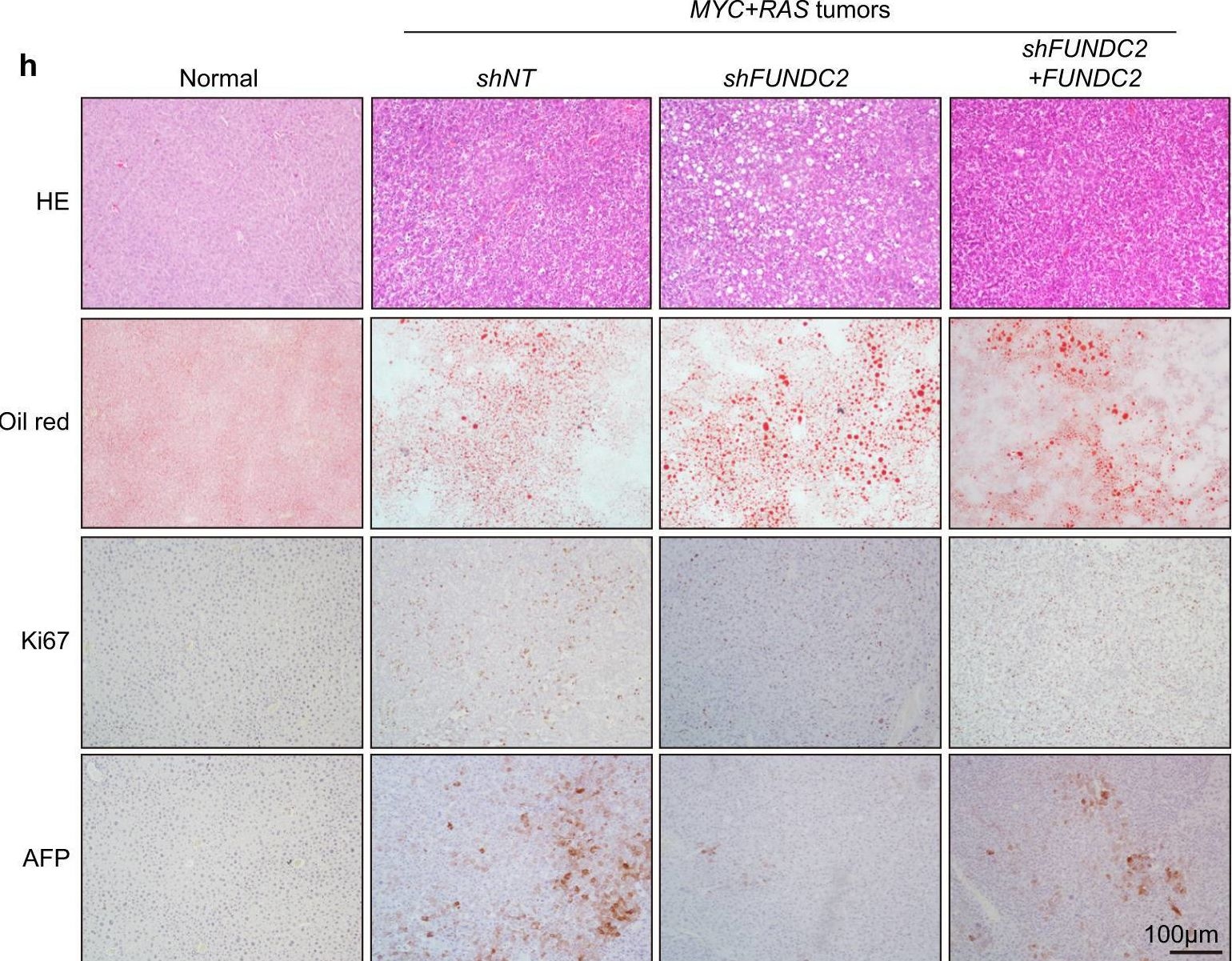 Fig.2.H showing Immunohistochemistry from the publication: FUNDC2 promotes liver tumorigenesis by inhibiting MFN1-mediated mitochondrial fusion.