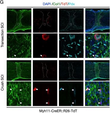 Fig.2.G from the publication: Heterogeneous fibroblasts contribute to fibrotic scar formation after spinal cord injury in mice and monkeys.