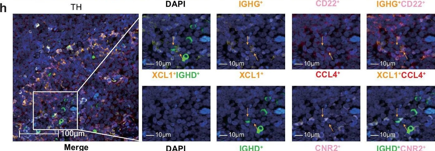 Fig.7.H showing Immunohistochemistry-immunofluorescence in a Homo sapiens (Human) sample from the publication: Parallel comparison of T cell and B cell subpopulations of adenoid hypertrophy and tonsil hypertrophy of children.