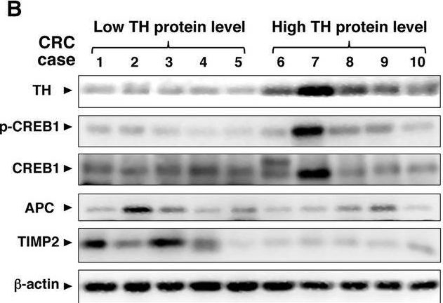 Fig.7.B showing Western Blotting from the publication: Norepinephrine-CREB1-miR-373 axis promotes progression of colon cancer.