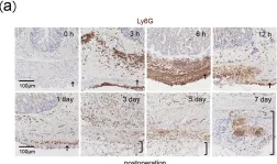 Fig.3.A showing Immunohistochemistry from the publication: Anti-interleukin-6 receptor antibody treatment ameliorates postoperative adhesion formation.