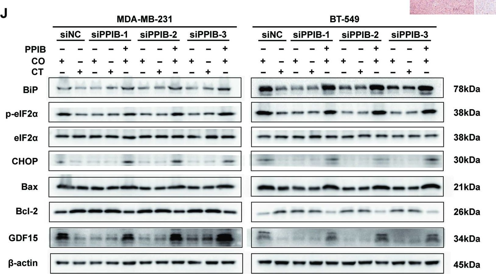 Fig.7.J showing Western Blotting in a Homo sapiens (Human) sample from the publication: A novel bystander effect in tamoxifen treatment: PPIB derived from ER+ cells attenuates ER- cells via endoplasmic reticulum stress-induced apoptosis.