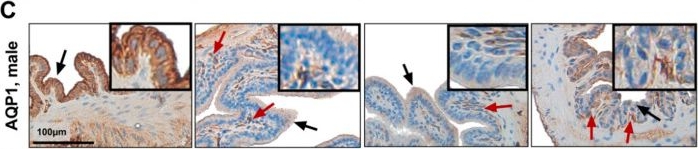 Fig.6.C showing Immunohistochemistry in a Mus musculus (House mouse) sample from the publication: Hepatobiliary Thyroid Hormone Deficiency Impacts Bile Acid Hydrophilicity and Aquaporins in Cholestatic C57BL/6J Mice.