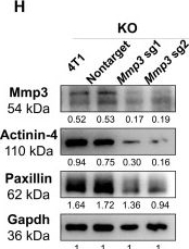 Fig.6.H showing Western Blotting from the publication: Dasatinib Inhibits Basal B Breast Cancer Through ETS1-Mediated Extracellular Matrix Remodeling.