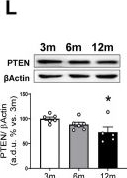 Fig.3.L showing Western Blotting from the publication: Development of Insulin and Leptin Resistance in the Mouse Brainstem with Age.