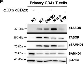 Fig.1.E showing Western Blotting in a Homo sapiens (Human) sample from the publication: HUSH-mediated HIV silencing is independent of TASOR phosphorylation on threonine 819.