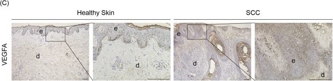 Fig.5.C showing Immunohistochemistry in a Homo sapiens (Human) sample from the publication: Loss of the translational repressor 4E-BP1 promotes skin carcinogenesis.