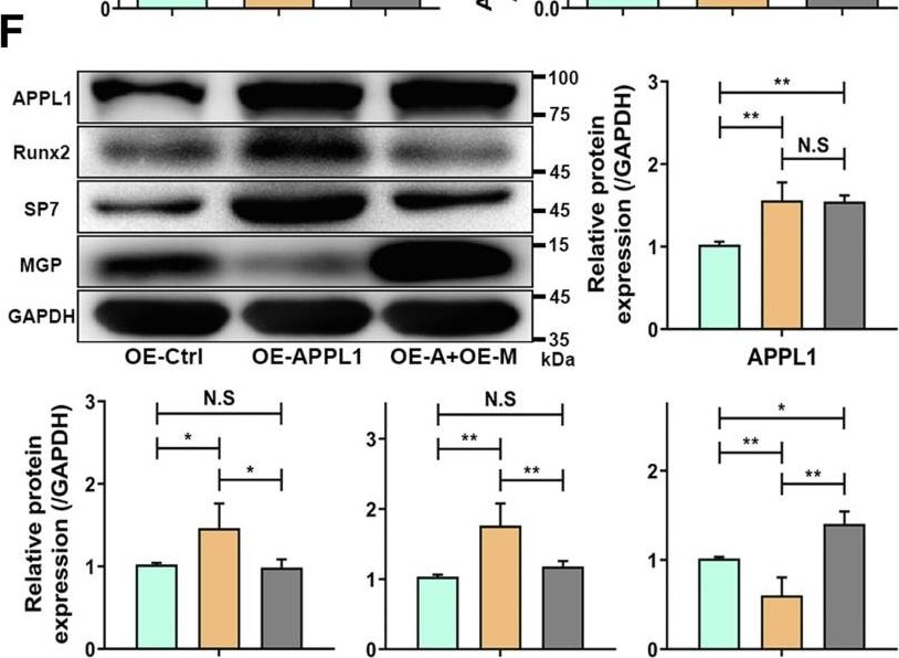 Fig.6.F showing Western Blotting from the publication: Reduced APPL1 impairs osteogenic differentiation of mesenchymal stem cells by facilitating MGP expression to disrupt the BMP2 pathway in osteoporosis.