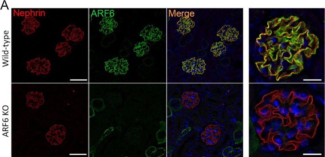 ARF6 mediates nephrin tyrosine phosphorylation-induced podocyte cellular dynamics.