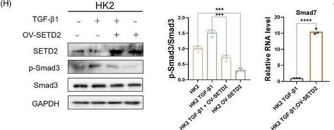 Fig.6.H showing Western Blotting in an Acipenser baerii (Siberian sturgeon) sample from the publication: SETD2 deficiency promotes renal fibrosis through the TGF-β/Smad signalling pathway in the absence of VHL.