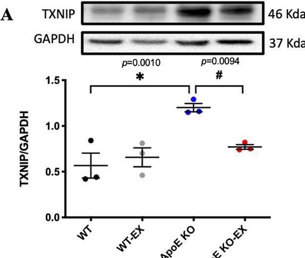 Fig.3.A showing Western Blotting from the publication: Exercise training mitigates ER stress and UCP2 deficiency-associated coronary vascular dysfunction in atherosclerosis.