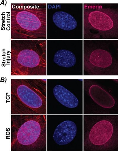 Fig.6.A showing Immunocytochemistry-immunofluorescence in a Mus musculus (House mouse) sample from the publication: Mechanical Stress Triggers Premature Senescence in Cardiac Fibroblasts.