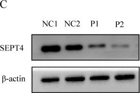 Fig.6.C showing Western Blotting in a Homo sapiens (Human) sample from the publication: Novel FSIP2 Variants Induce Super-Length Mitochondrial Sheath and Asthenoteratozoospermia in Humans.