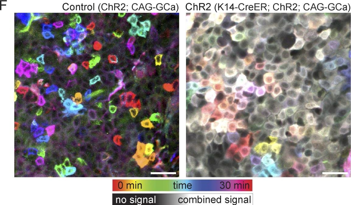Cell cycle controls long-range calcium signaling in the regenerating epidermis.