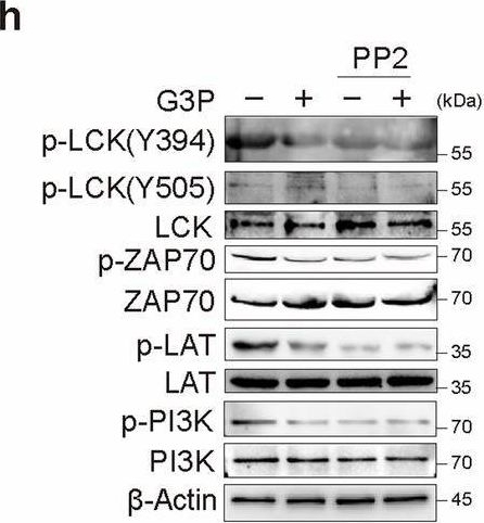 Fig.5.H showing Western Blotting in a Homo sapiens (Human) sample from the publication: VCP downstream metabolite glycerol-3-phosphate (G3P) inhibits CD8+T cells function in the HCC microenvironment.