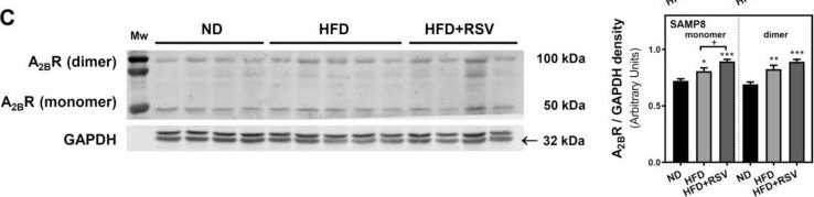 Fig.4.C showing Western Blotting from the publication: High-Fat and Resveratrol Supplemented Diets Modulate Adenosine Receptors in the Cerebral Cortex of C57BL/6J and SAMP8 Mice.