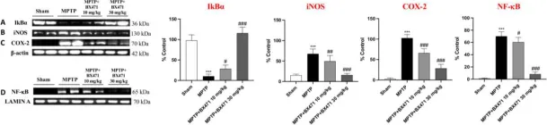 Fig.6.A showing Western Blotting in a Mus musculus (House mouse) sample from the publication: Novel Findings on CCR1 Receptor in CNS Disorders: A Pathogenic Marker Useful in Controlling Neuroimmune and Neuroinflammatory Mechanisms in Parkinson's Disease.