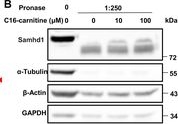 Fig.6.B showing Western Blotting from the publication: Palmitoyl-carnitine Regulates Lung Development by Promoting Pulmonary Mesenchyme Proliferation.