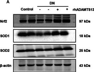 Fig.5.A showing Western Blotting in a Mus musculus (House mouse) sample from the publication: ADAMTS13 ameliorates diabetic nephropathy by Nrf2/GPX4/eNOS signaling pathway.