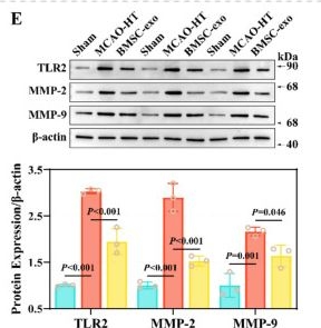 Fig.2.E showing Western Blotting from the publication: BMSC-Derived Exosomal miR-21a-5p Ameliorates Blood-Brain Barrier Injury and Hemorrhagic Transformation.
