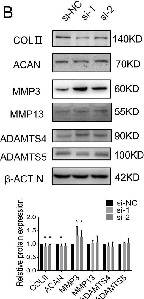 Fig.2.B showing Western Blotting in a Homo sapiens (Human) sample from the publication: LncRNA WDR11-AS1 Promotes Extracellular Matrix Synthesis in Osteoarthritis by Directly Interacting with RNA-Binding Protein PABPC1 to Stabilize SOX9 Expression.