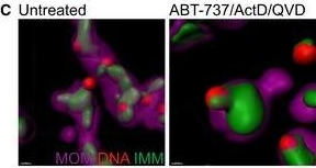 Mitochondrial inner membrane permeabilisation enables mtDNA release during apoptosis.