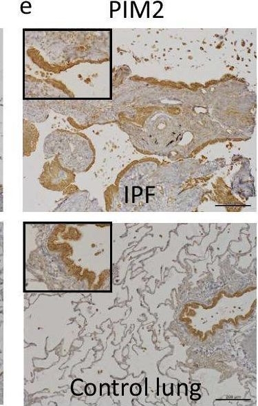Pim2 PIM2 antibodies - Antibody search engine - CiteAb
