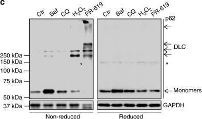 Oxidation of SQSTM1/p62 mediates the link between redox state and protein homeostasis.