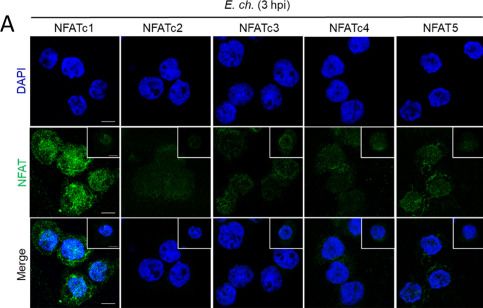 Fig.1.A showing Immunocytochemistry-immunofluorescence in an Ehrlichia chaffeensis sample from the publication: TRP120-dependent activation of noncanonical Wnt/NFAT signaling drives monocyte chemokine production in Ehrlichia chaffeensis infection.
