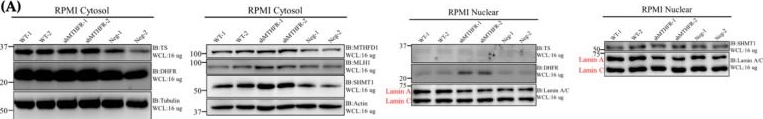 Fig.3.A showing Western Blotting from the publication: MTHFR Knockdown Assists Cell Defense against Folate Depletion Induced Chromosome Segregation and Uracil Misincorporation in DNA.