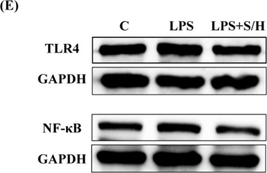 Fig.3.E showing Western Blotting in a Mus musculus (House mouse) sample from the publication: Combating Traumatic Brain Injury: A Dual-Mechanism Hydrogel Delivering Salvianolic Acid A and Hydroxysafflor Yellow A to Block TLR4/NF-κB and Boost Angiogenesis.